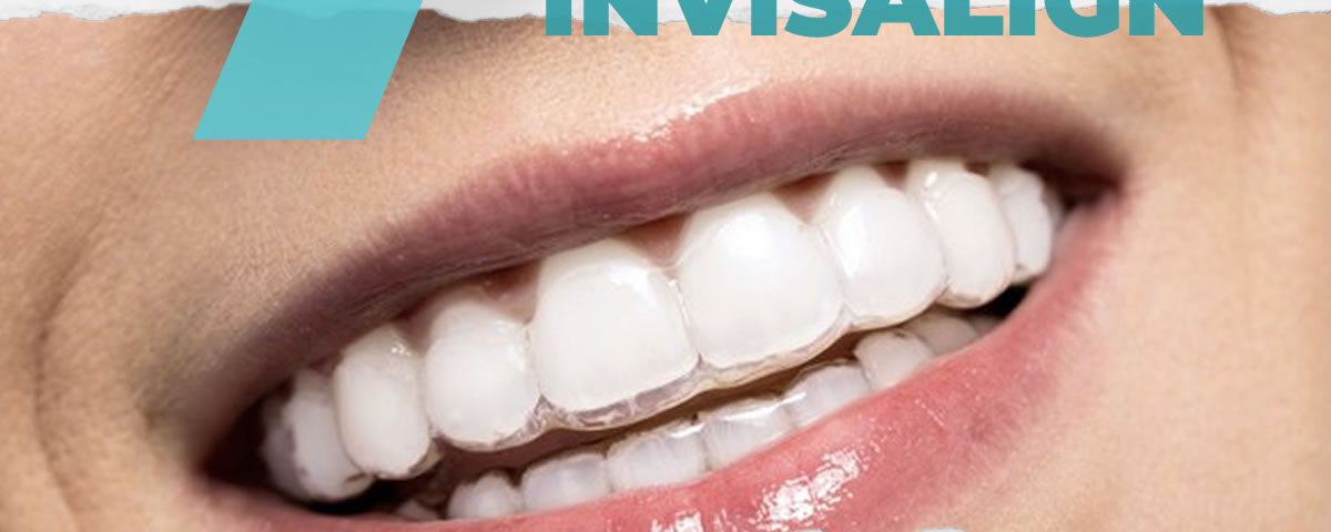 invisalign